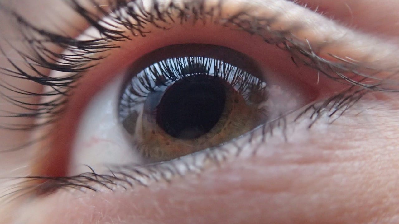 How to Reduce Cataract Progression