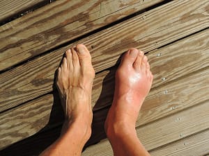 swollen
